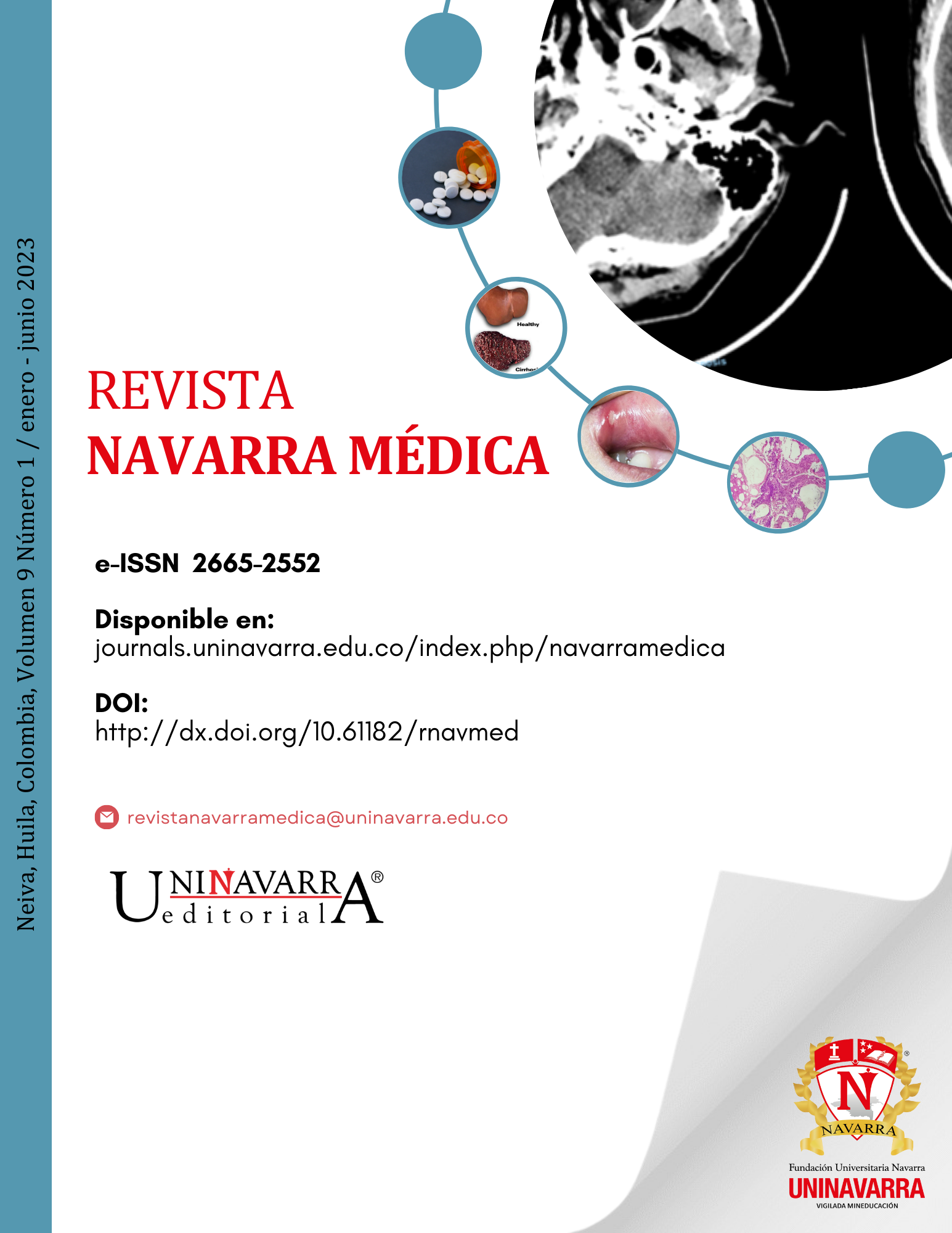 					Ver Vol. 9 Núm. 1 (2023): Revista Navarra Médica
				